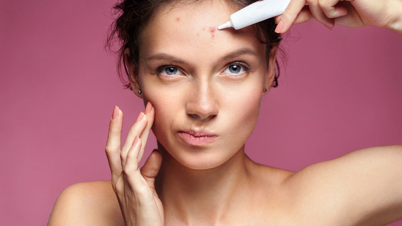 How to treat chapped skin caused by acne medications