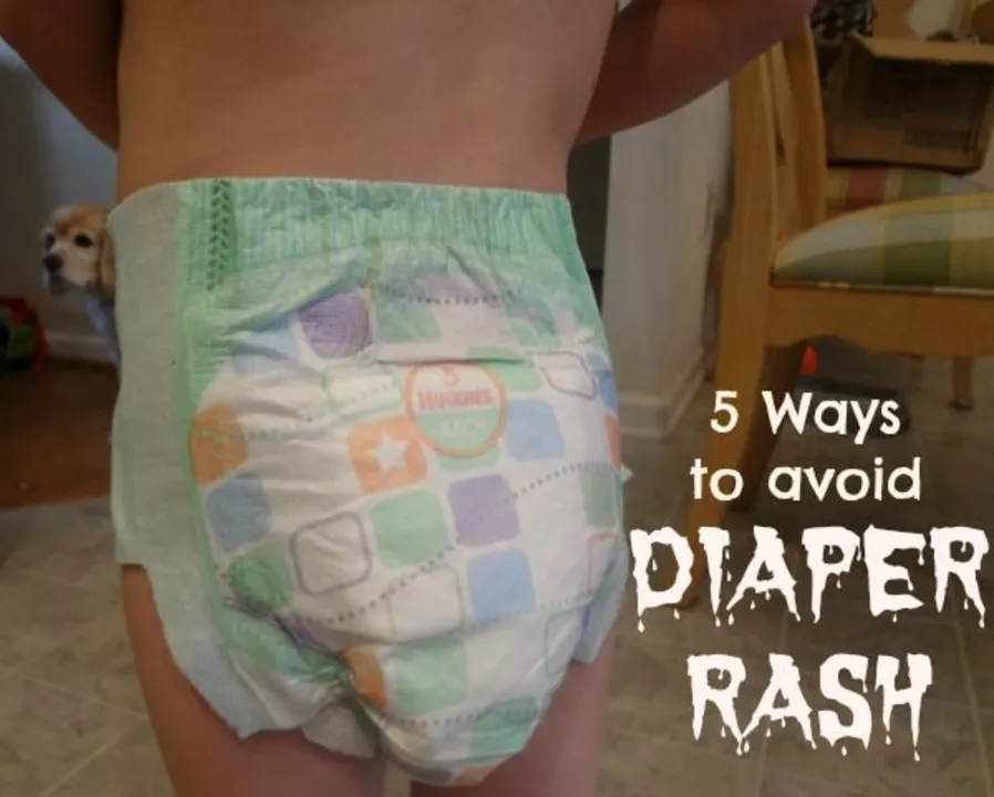 Diaper rash and daycare: Tips for keeping your baby comfortable